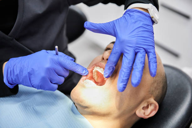 Best Emergency Tooth Extraction in Crestwood Village, NJ