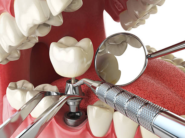 Best Pediatric Emergency Dentist in Crestwood Village, NJ