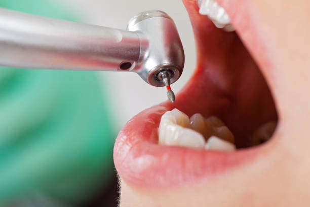 Best Emergency Tooth Extraction in Crestwood Village, NJ